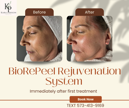 BioRePeel Rejuvenation System MODEL